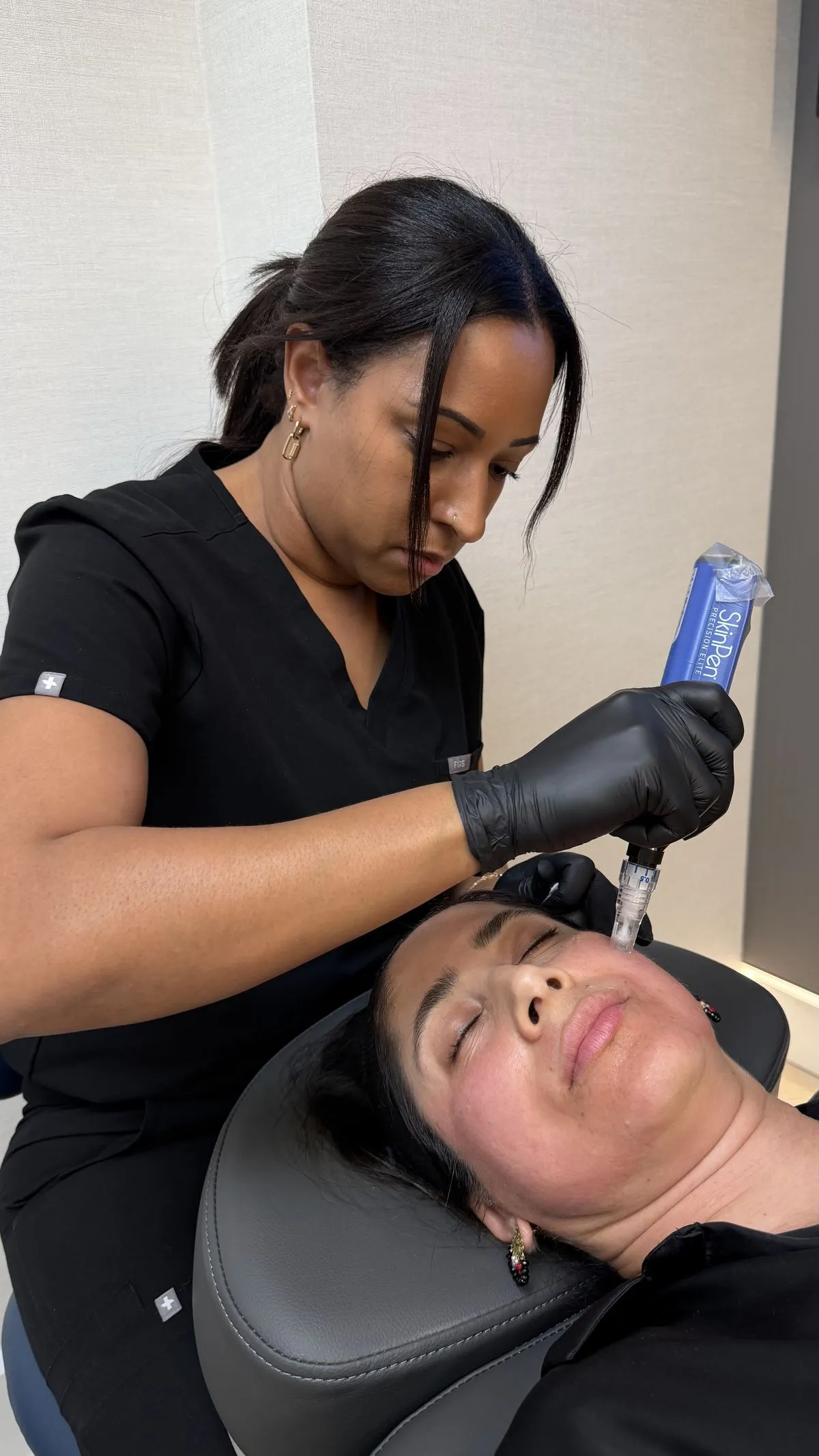 Microneedling treatment